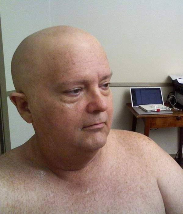 Bald cap: 