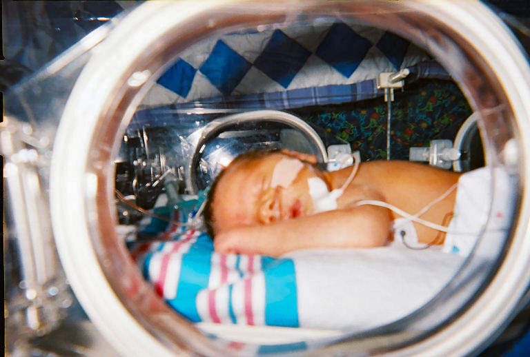 Neonatal intensive care unit: Intensive care unit specializing in the care of ill or premature newborn infants