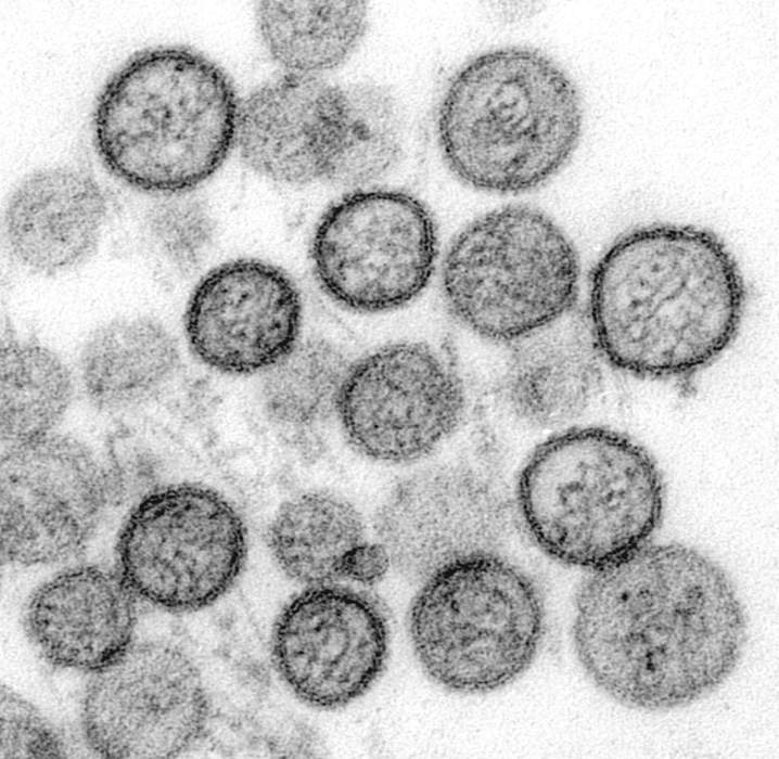 Orthohantavirus: Genus of viruses