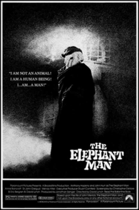 The Elephant Man (film): 1980 film directed by David Lynch